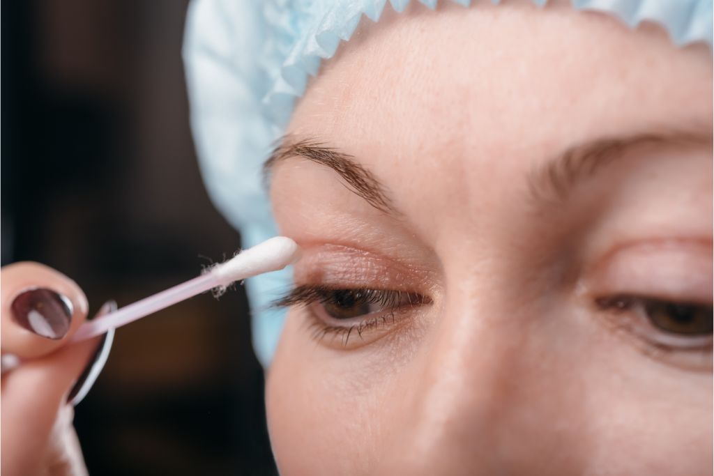 Blefaroplastia: o que você precisa saber