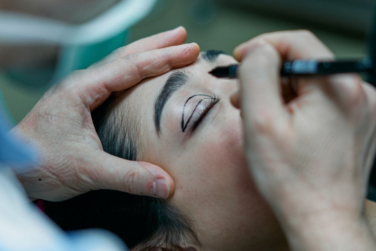 Blefaroplastia superior: como funciona? Qual o valor?