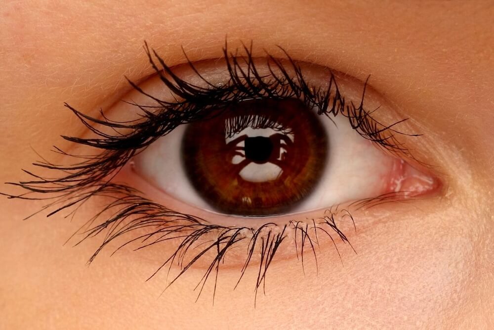 Cirurgia de glaucoma: como funciona