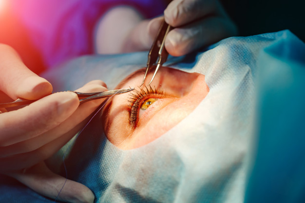 cirurgia ocular