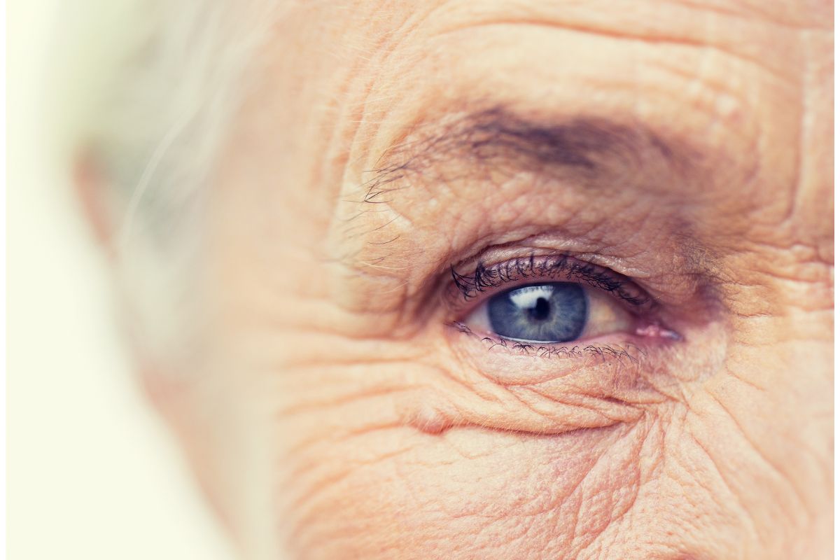 Como prevenir catarata? É possível?