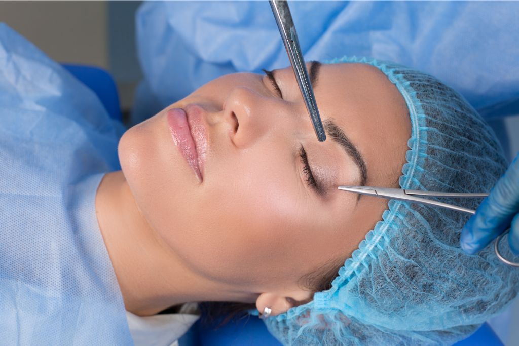 Blefaroplastia: tudo sobre a cirurgia de pálpebras