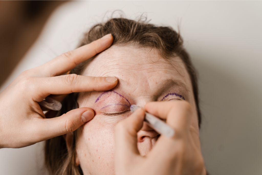 Cirurgia plástica de pálpebras gratuita: como fazer?