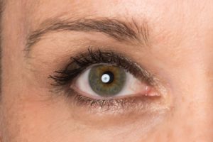 Heterocromia central